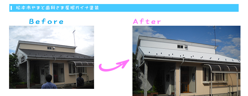 松本市やまと歯科さま屋根ガイナ塗装